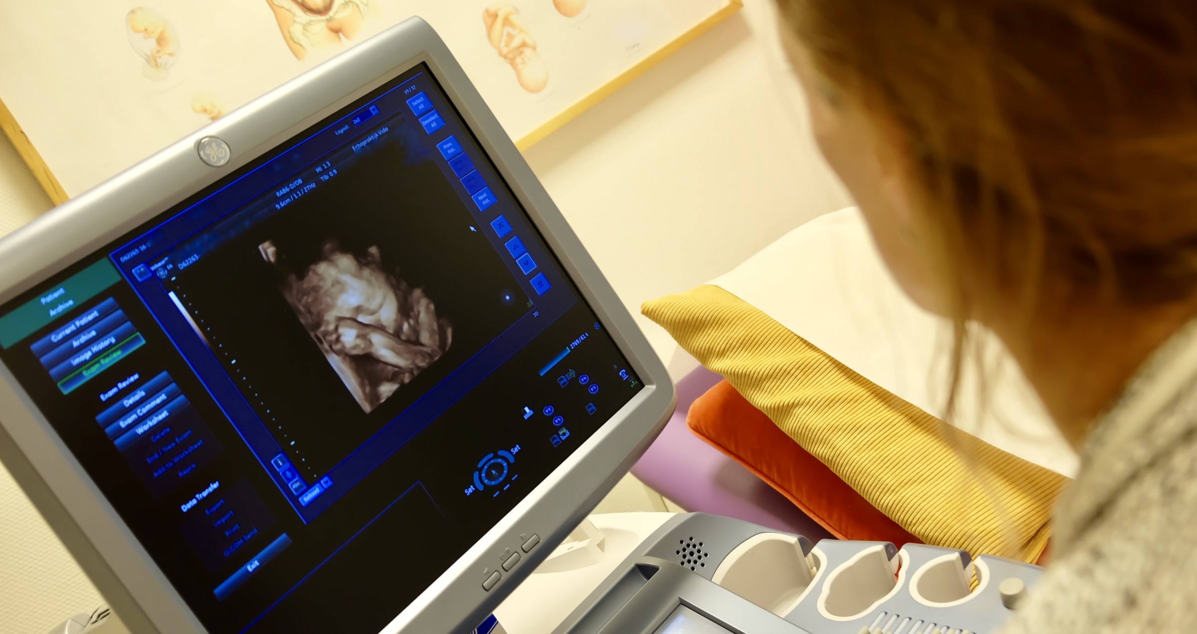 3D/4D HD Live ultrasounds - Vida Verloskundigen & Echopraktijk